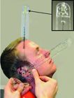 10044c Baseline Goniometer 12 Absolute 714905021878