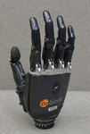 Ottobock Bebionic Myoelectric Prosthetic Hand, Right RSL-RP609. Fixed Price $1495.00.