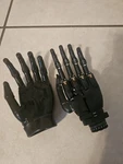 Touch Bionics I-limb System Ottobock Myoelectric Prosthetic Hand Left. Fixed Price $2000.00.