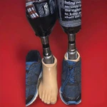 Ottobock Prosthetic Leg With Foot 1C30-1 Mpn Complete Adult Medical Device. Fixed Price $335.00.